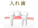 入れ歯