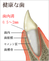 歯周病の進行