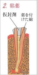 2.貼薬